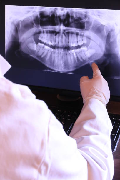 Best Emergency Root Canal Treatment in Clarksville, TX