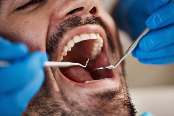 Best Pediatric Emergency Dentist in Clarksville, TX